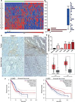 Overexpression of RhoV Promotes the Progression and EGFR-TKI Resistance of Lung Adenocarcinoma